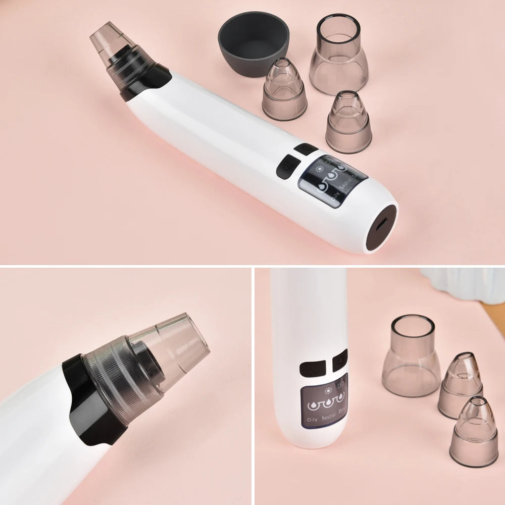Limpiador de Poros al Vacío DearBeauty – Succión Facial Profunda